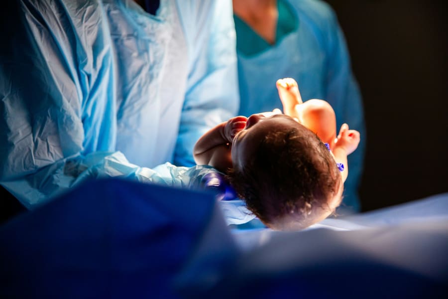 Kejsersnittet har været banebrydende for at gøre fødsler mere sikre, men det er ikke altid den bedste løsning. Foto:iStock/adamkaz