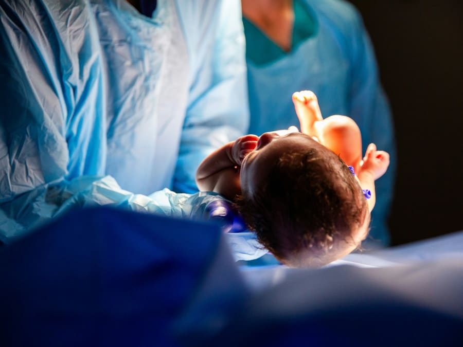 Kejsersnittet har været banebrydende for at gøre fødsler mere sikre, men det er ikke altid den bedste løsning. Foto:iStock/adamkaz